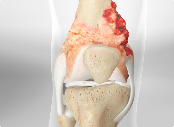 knee