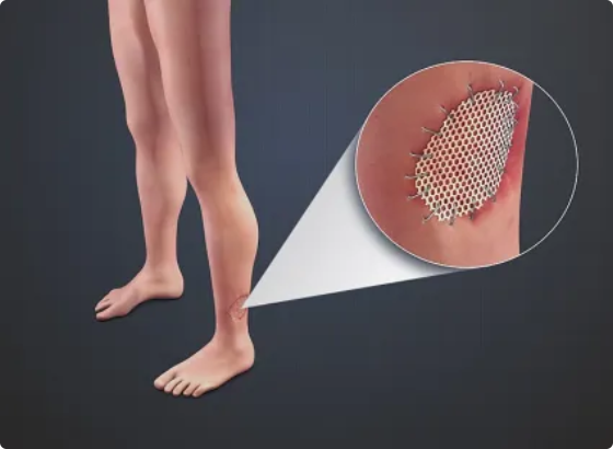 knee