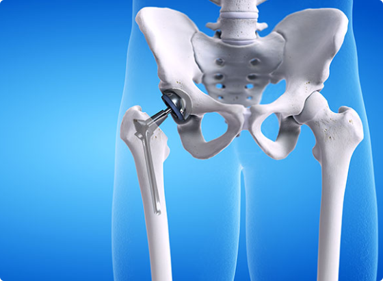 knee